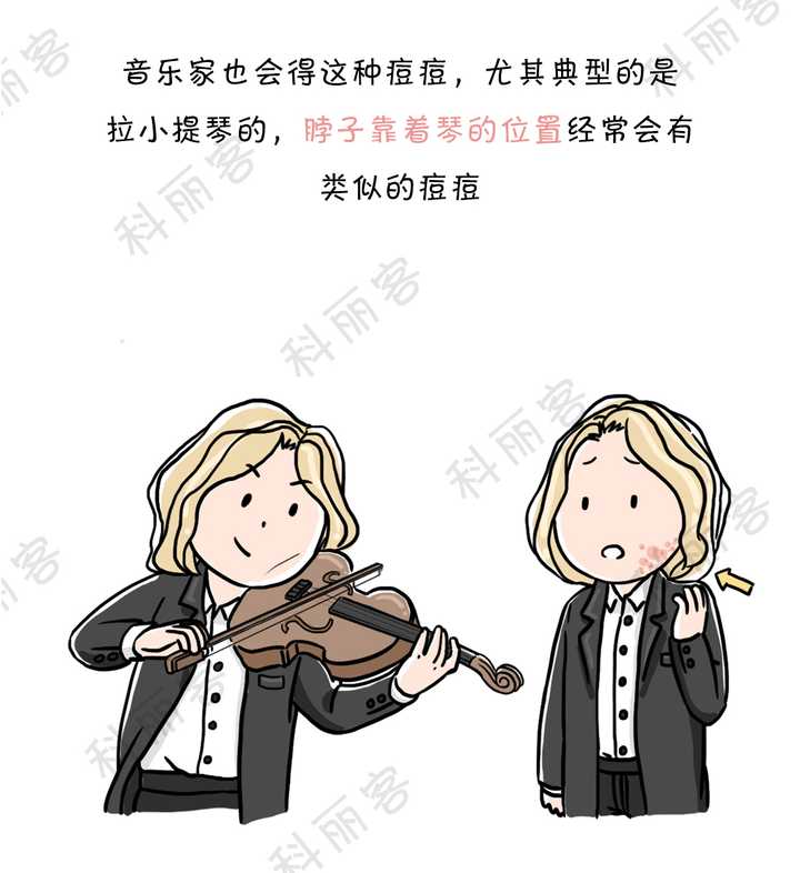 运动与睡眠充足为什么还会长痘? - 知乎