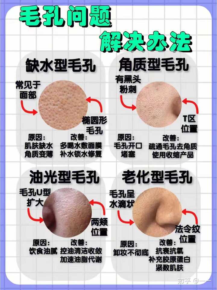 脸部毛孔粗大如何解决? - 知乎