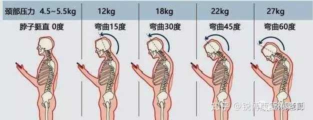 脖子后面鼓起来一个包 应该就是颈椎突出?