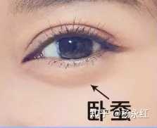 什么是 卧蚕 它跟眼袋有什么区别 知乎 什么是 卧蚕 它跟眼袋有什么区别 知乎