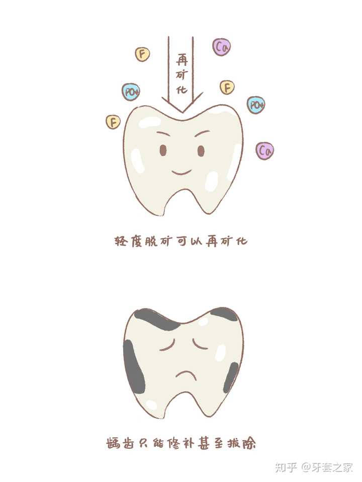 什么是牙齿脱矿? - 知乎
