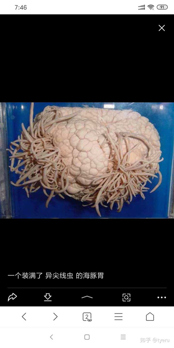 大脑寄生虫初期症状图片