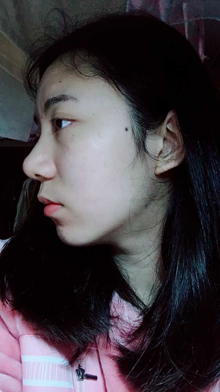 有没有因为鼻子不好看而毁了整张脸的例子?