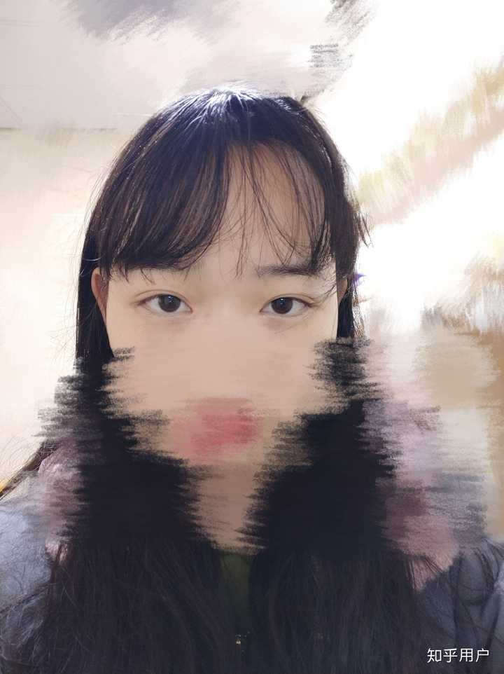 内双和外双的区别是什么?因为有人告诉我,双眼皮的褶皱和眼角有交点就是内双,无论你的双眼皮多宽? - 知乎