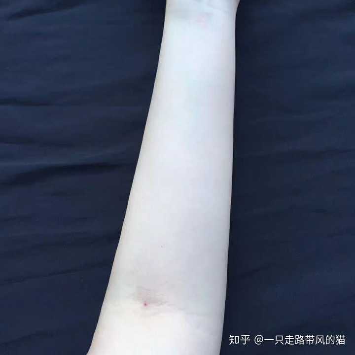 皮肤白到什么程度?你怎么把皮肤养白的,有图可以回答?