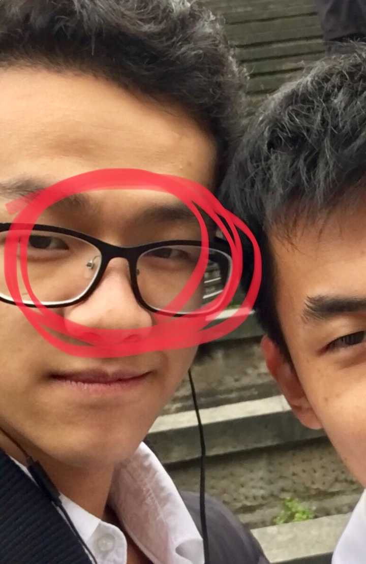 全切双眼皮价格_郑大一附院割双眼皮价格_双眼皮的价格