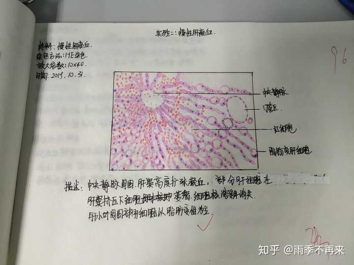 为什么咱们不弄个病理红蓝手绘图的问题呢?