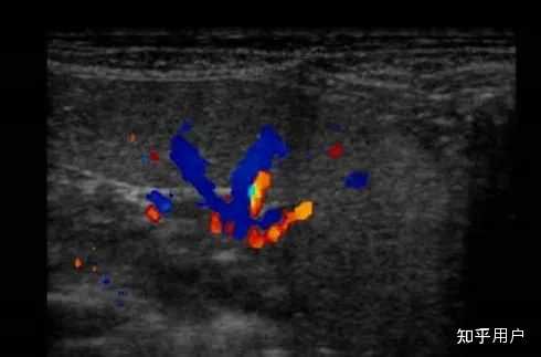脾，在哪个部位？ - 知乎