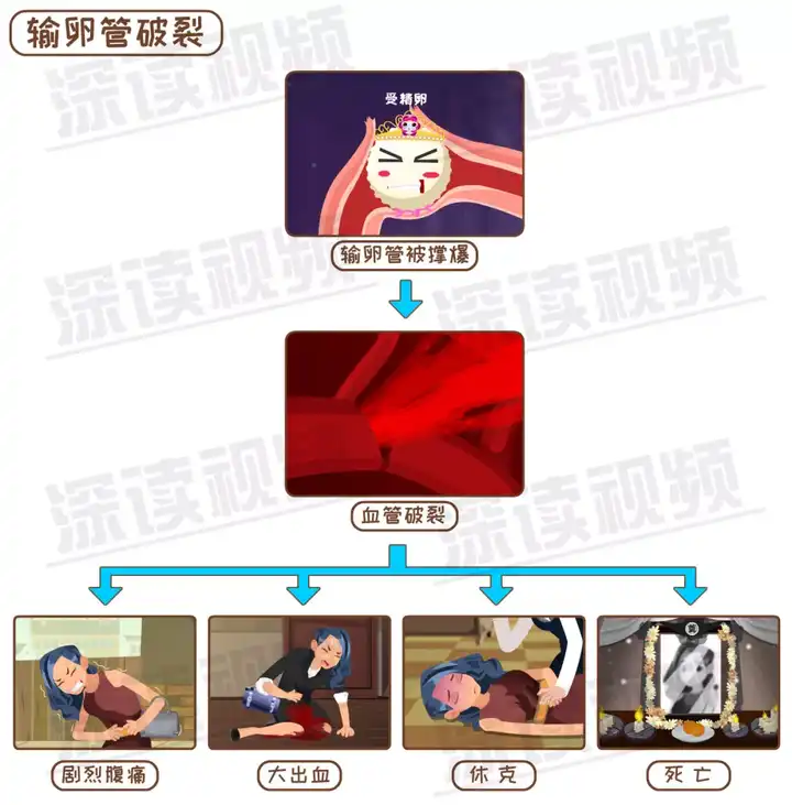大学生未婚却宫外孕怎么办 知乎 大学生未婚却宫外孕怎么办 知乎