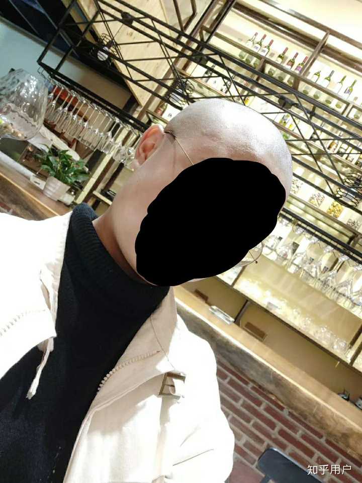 头圆是一种怎样的体验?
