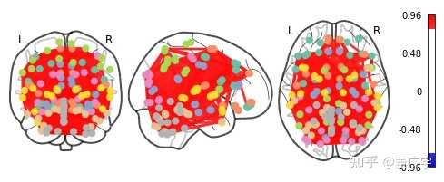 请问一个完整的处理fMRI数据的流程是怎样的？ - 知乎