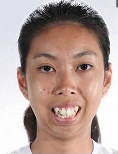 整形底子怎么看呢?