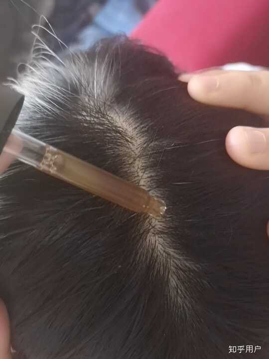 有没有特别见效的护发心得 知乎