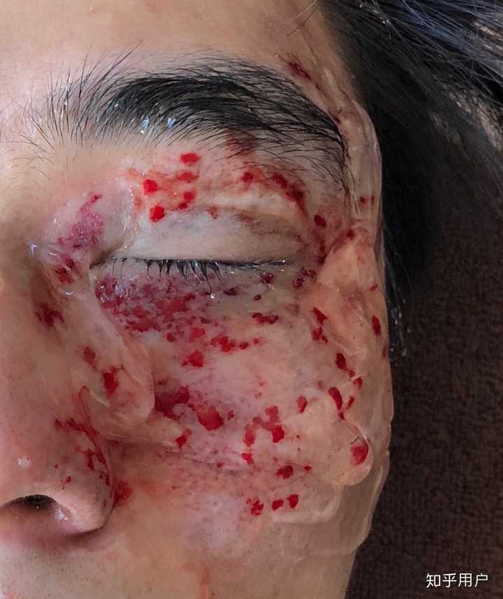 脸上有胎记是一种怎样的体验?