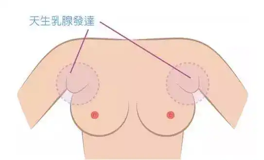 副乳怎么通过锻炼减掉 知乎