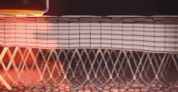 射频美容仪器对身体有副作用吗 知乎