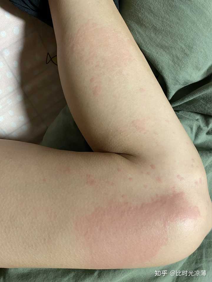 7mepvglkephccm 7mepvglkephccm