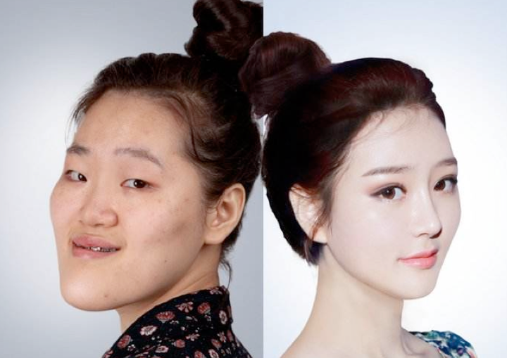 女生鼻子和眼睛哪个对面部改善大?