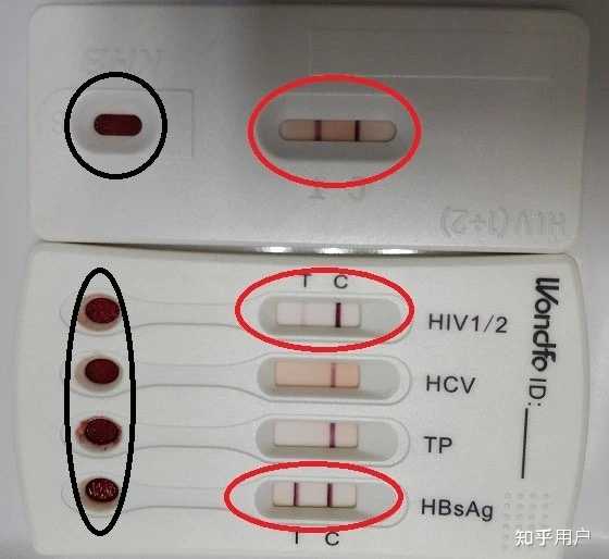 请问万孚四合一试纸测HIV准吗? - 知乎