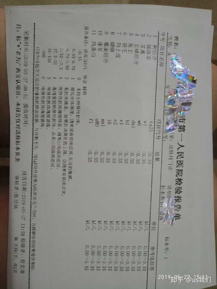 大家做过过敏原测试么 都有哪些 我可以带着我怀疑的过敏原去测试么 知乎 大家做过过敏原测试么 都有哪些 我可以带着我怀疑的过敏原去测试么 知乎