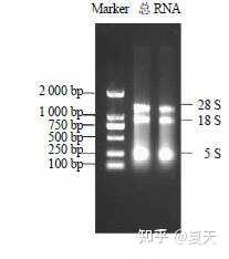 想请问一下用天根试剂盒提取植物中RNA，跑出来的条带是这个样子是什么原因啊？ - 知乎