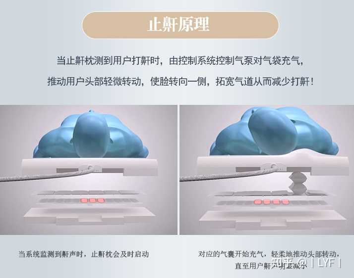 止鼾器是否真的管用 那一种类型的止鼾器管用呢 知乎 止鼾器是否真的管用 那一种类型的止鼾器管用呢 知乎