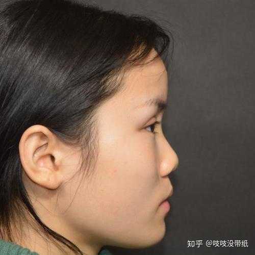 鼻子多低才算塌鼻子? - 知乎