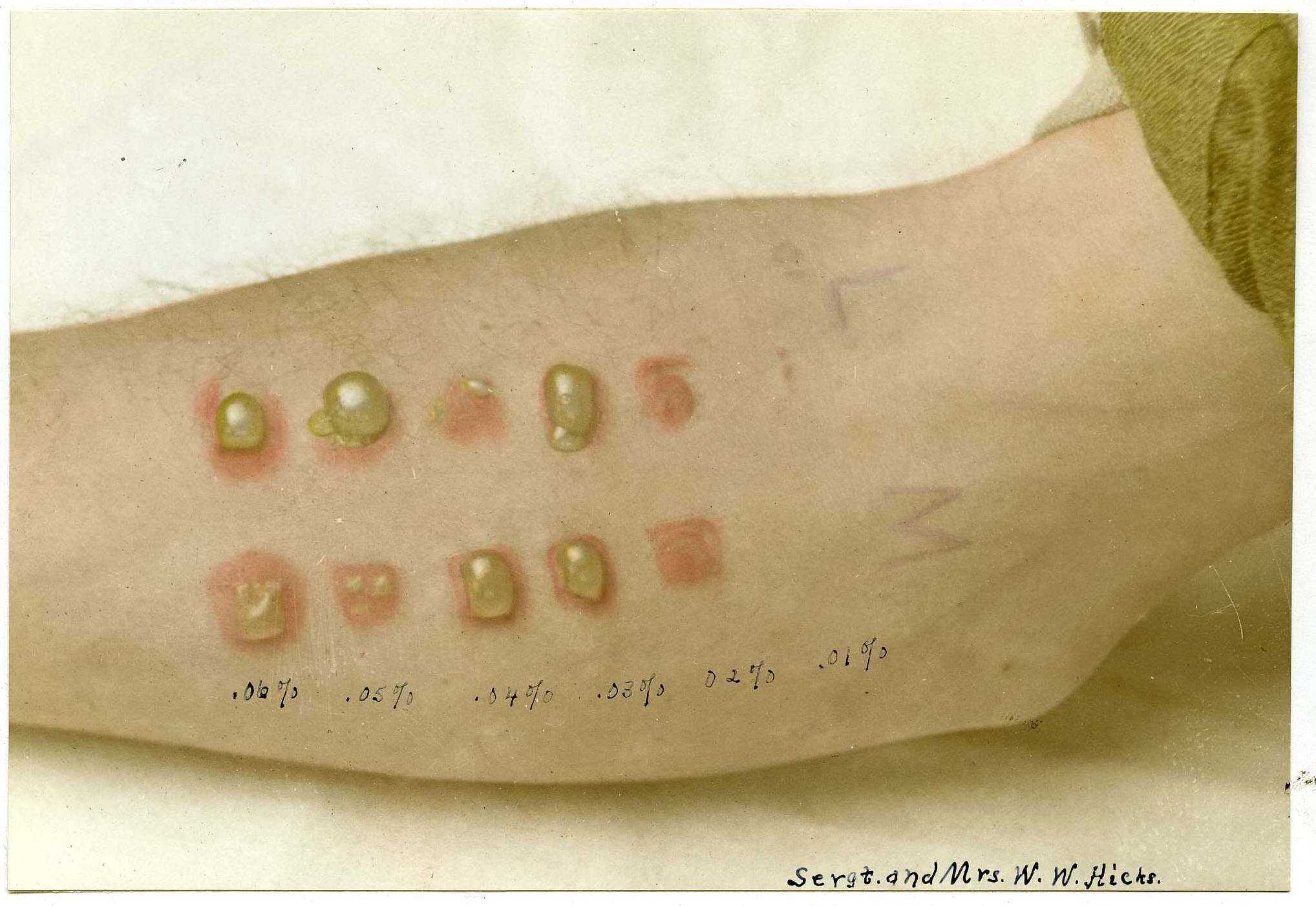 工业生产性价比最高的是芥子气和路易斯毒气 .