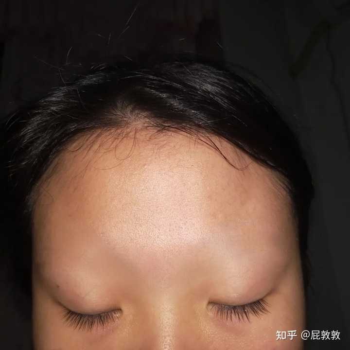 睫毛增长液是真的能长睫毛而没有副作用吗 屁敦敦的回答 知乎