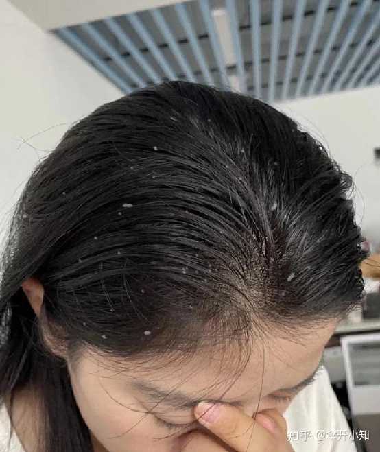 最近有点穷，想问问有没有便宜一点的发膜？ - 知乎