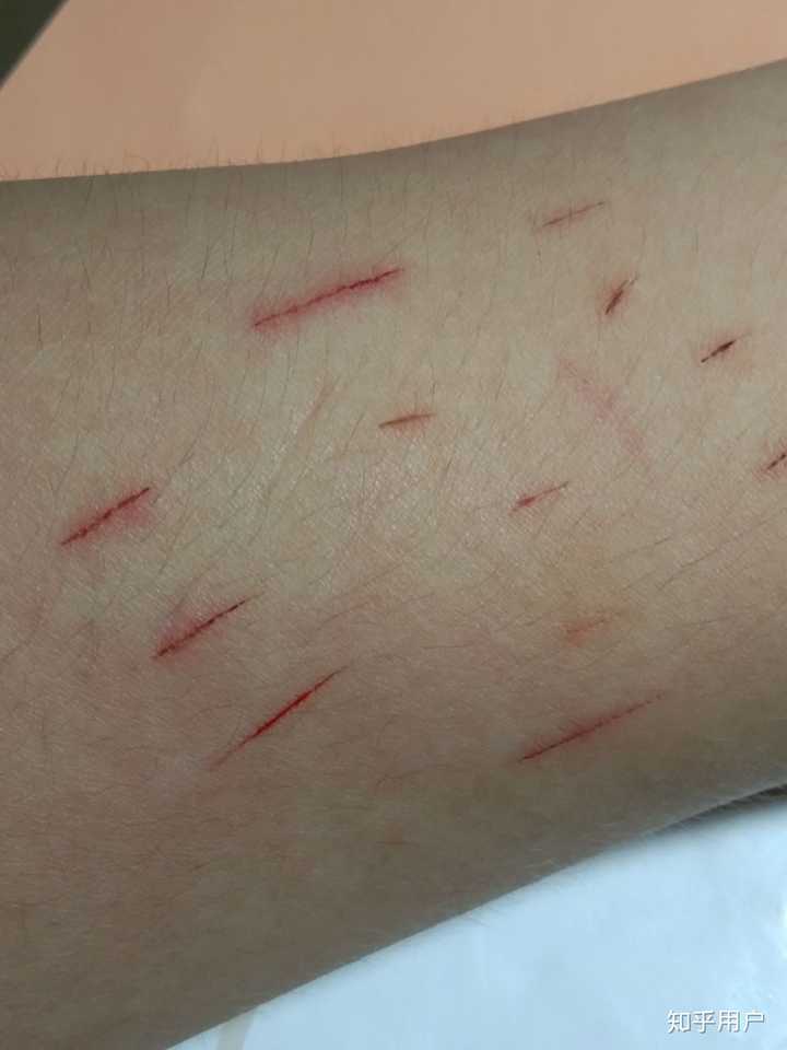 父母知道自己孩子自残会怎么样?