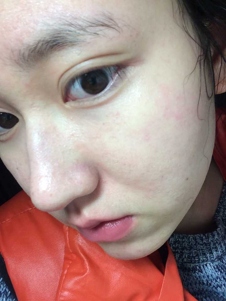 长得好看但是皮肤很差是一种怎样的体验?