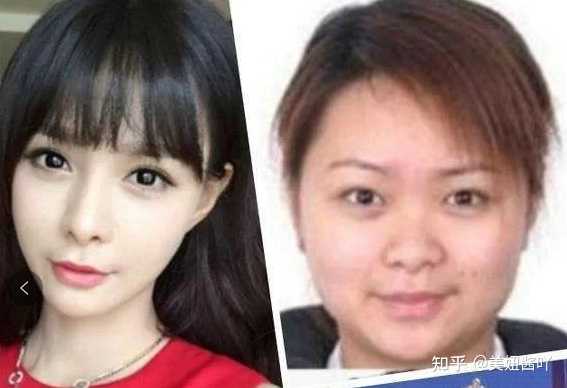 有哪些整容 微整特别成功的明星 知乎