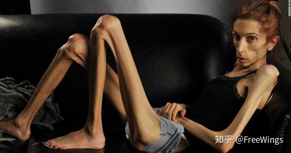 每天吃300左右大卡,坚持半个月大概能瘦多少斤?