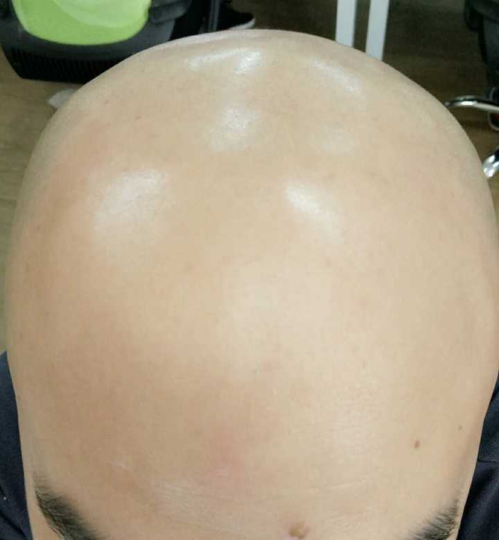 剃光头对自身有什么坏处 知乎