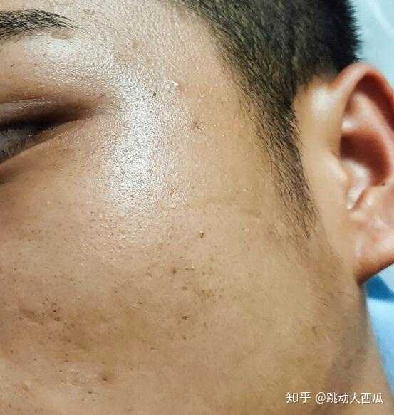 男生如何让脸部皮肤变得好?