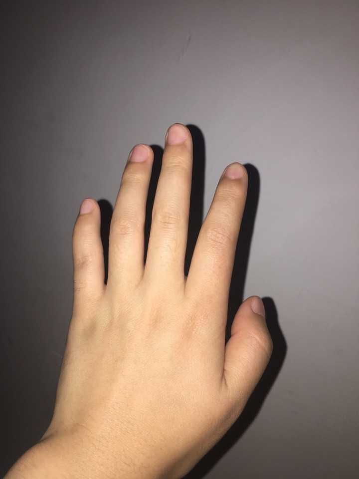 身材很瘦,手很胖是一种什么体验.