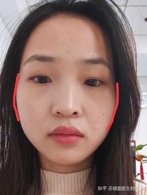 我的侧脸很平,鼻子塌,但是也不想整容,怎么改善呢?