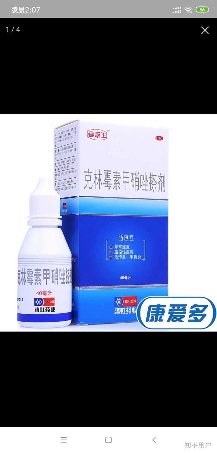 祛痘方法有哪些?