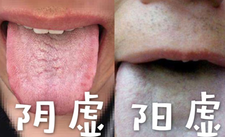 肾阳虚和肾阴虚怎样可以一起补? - 知乎