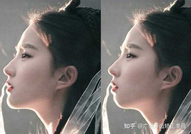 侧脸好不好看的评判标准到底是什么？ - 知乎