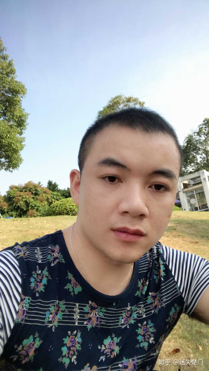 脱发对于一个二十几的小伙有多大伤害?
