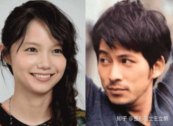 颜值比较高的日本女明星有哪些 整形医生王立鹏的回答 知乎 颜值比较高的日本女明星有哪些 整形医生王立鹏的回答 知乎