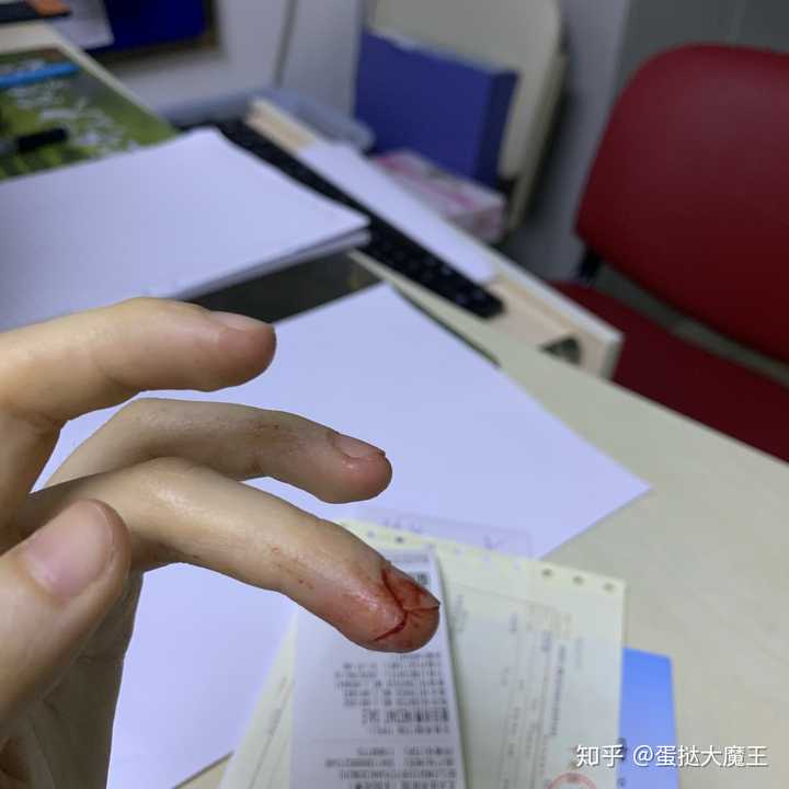 平时手指被割伤应该怎么处理? - 知乎