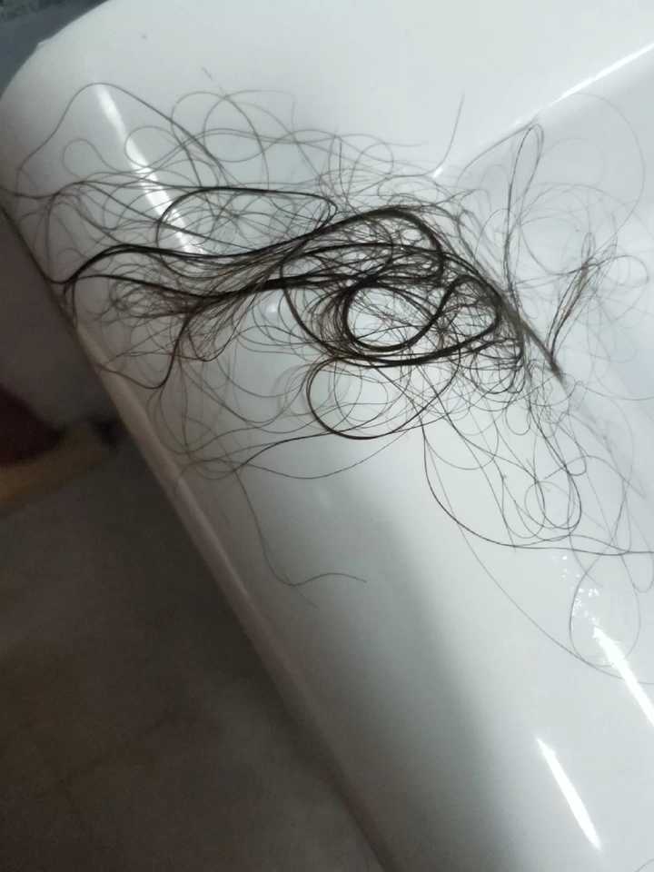 女生掉头发特别厉害该怎么解决？