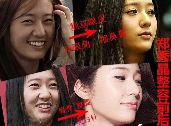 Boa 整形前画像 Boa 整形前画像