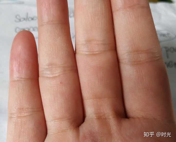 如何用左手无名指的一颗痣来写一个故事？