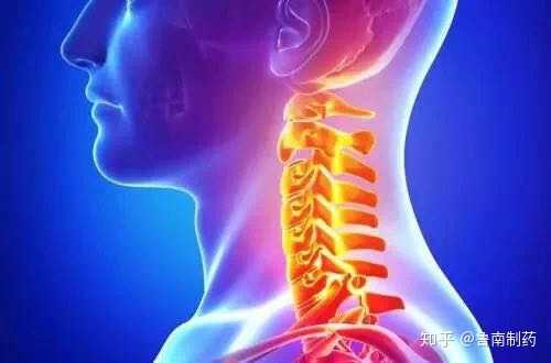 患颈椎病是怎样一种体验 知乎 患颈椎病是怎样一种体验 知乎