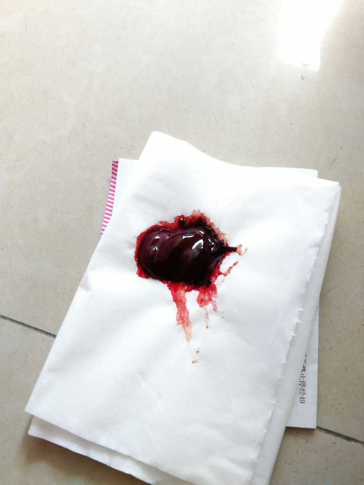 药流期间以及药流后有什么要注意的？