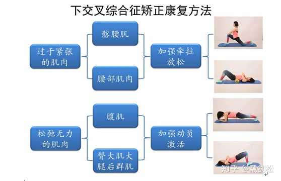 如何科学地判断自己是否患骨盆前倾 如何矫正骨盆前倾 如何注意平时的站姿坐姿 知乎